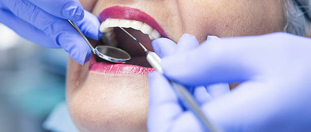 Best Emergency Gum Treatment in Northeast Ithaca, NY